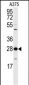 YWHAZ Antibody (T232)